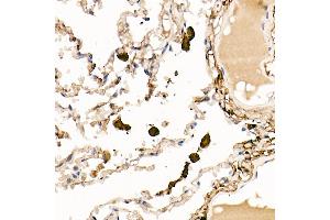 Immunohistochemistry of paraffin-embedded rat kidney using Ferritin Light Chain Rabbit pAb (ABIN6133515, ABIN6140791, ABIN6140792 and ABIN6218871) at dilution of 1:150 (40x lens). (FTL 抗体  (AA 1-175))