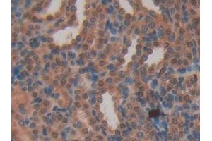 Detection of MYH6 in Rat Kidney Tissue using Polyclonal Antibody to Myosin Heavy Chain 6, Cardiac Muscle, Alpha (MYH6)