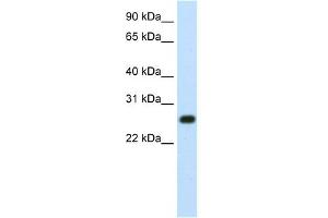 WB Suggested Anti-MINA Antibody Titration:  1. (MINA 抗体  (N-Term))