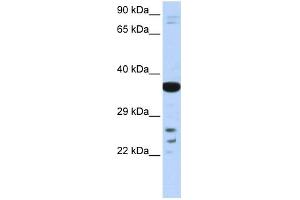 WB Suggested Anti-VSX1 Antibody Titration:  0. (VSX1 抗体  (Middle Region))