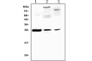anti-C-Reactive Protein (CRP) (AA 20-225) antibody