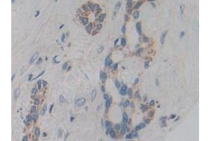 Immunohistochemistry (IHC) image for anti-Cytochrome P450, Family 21, Subfamily A, Polypeptide 2 (CYP21A2) (AA 106-389) antibody (ABIN7441886)