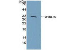 Western blot analysis of recombinant Human KLF5. (KLF5 抗体  (AA 216-457))