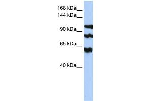 WB Suggested Anti-PPP1R13B Antibody Titration:  0. (PPP1R13B 抗体  (Middle Region))