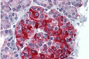 Human Pancreas: Formalin-Fixed, Paraffin-Embedded (FFPE) (RBP4 抗体  (AA 19-202))