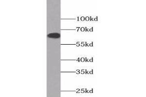Western blot analysis of HEK-293 cells using COX2 Antibody (1/600 dilution) (COX2 抗体)