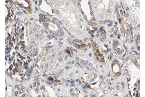 ABIN6267589 at 1/100 staining human kidney tissue sections by IHC-P. (RELB 抗体  (pSer573))
