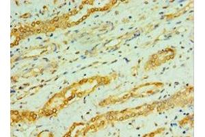 Immunohistochemistry of paraffin-embedded human kidney tissue using ABIN7146759 at dilution of 1:100 (CPA1 抗体  (AA 111-419))