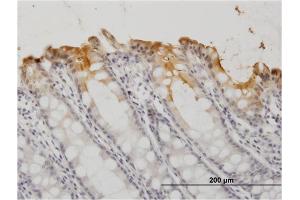 Immunoperoxidase of monoclonal antibody to CEACAM1 on formalin-fixed paraffin-embedded human colon. (CEACAM1 抗体  (AA 1-468))