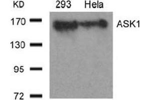 Image no. 3 for anti-Mitogen-Activated Protein Kinase Kinase Kinase 5 (MAP3K5) (Ser966) antibody (ABIN197326)