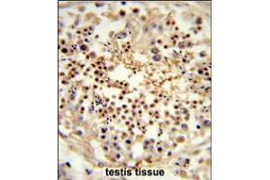 Formalin-fixed and paraffin-embedded human testis tissue reacted with UNC119 Antibody , which was peroxidase-conjugated to the secondary antibody, followed by DAB staining. (UNC119 抗体  (AA 64-94))
