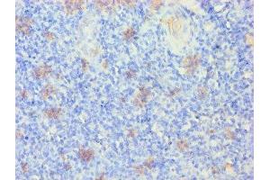 Immunohistochemistry of paraffin-embedded human tonsil tissue using ABIN7157384 at dilution of 1:100 (KRT14 抗体  (AA 1-472))