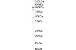 ABIN185626 (1µg/ml) staining of human colon lysate (35µg protein in RIPA buffer). (CTNNA1 抗体  (Internal Region))