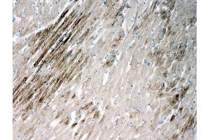 Anti-HSPB2 antibody, IHC(F) IHC(F): Rat Cardiac Muscle Tissue (HSPB2 抗体  (Middle Region))