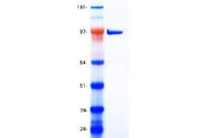 Validation with Western Blot (SIRT1 Protein (Transcript Variant 1) (Myc-DYKDDDDK Tag))