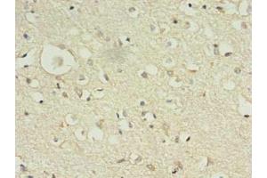 Immunohistochemistry of paraffin-embedded human brain tissue using ABIN7157583 at dilution of 1:100 (KIF12 抗体  (AA 213-450))