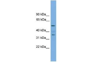 WB Suggested Anti-Nobox Antibody Titration: 0. (NOBOX 抗体  (Middle Region))