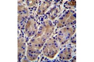 Immunohistochemistry (Paraffin-embedded Sections) (IHC (p)) image for anti-Potassium Inwardly-Rectifying Channel, Subfamily J, Member 13 (KCNJ13) (AA 74-103), (N-Term) antibody (ABIN953008)