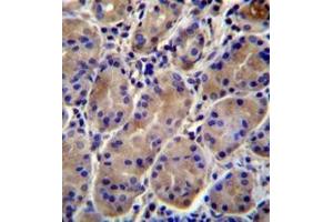 Immunohistochemistry analysis in formalin fixed and paraffin embedded human stomach tissue reacted with KCNJ13 Antibody (N-term) followed which was peroxidase conjugated to the secondary antibody and  followed by DAB staining.