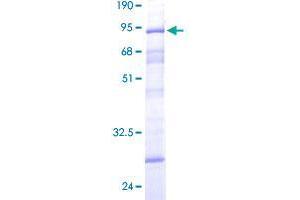 DCP2 Protein (AA 1-385) (GST tag)