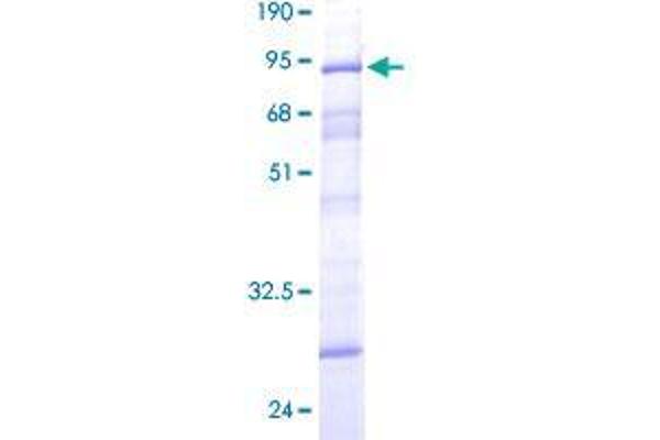 DCP2 Protein (AA 1-385) (GST tag)