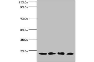 Western blot All lanes: UBE2V2 antibody at 3 μg/mL Lane 1: Hela whole cell lysate Lane 2: Mouse brain tissue Lane 3: Jurkat whole cell lysate Lane 4: K562 whole cell lysate Secondary Goat polyclonal to rabbit IgG at 1/10000 dilution Predicted band size: 16 kDa Observed band size: 16 kDa (UBE2V2 抗体  (AA 1-145))
