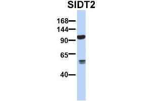 Host:  Rabbit  Target Name:  SERPINA3  Sample Type:  Human Adult Placenta  Antibody Dilution:  1. (SIDT2 抗体  (N-Term))