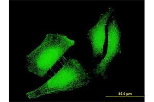 Immunofluorescence of monoclonal antibody to FOXO3 on HeLa cell. (FOXO3 抗体  (AA 361-460))