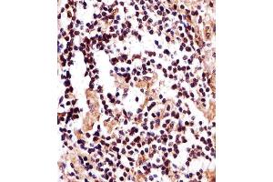 Immunohistochemical analysis of paraffin-embedded H. (IZUMO2 抗体  (AA 90-124))