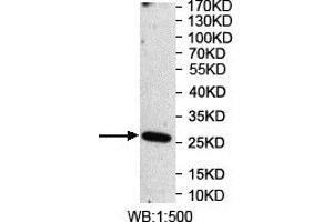 Western blot analysis of recombinant protein using OSGIN2 Antibody. (OSGIN2 抗体)