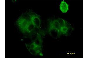 Immunofluorescence of monoclonal antibody to GCA on MCF-7 cell. (Grancalcin 抗体  (AA 1-217))