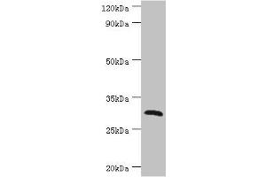 Western blot All lanes: C-type lectin domain family 12 member A antibody at 2 μg/mL + Mouse skeletal muscle tissue Secondary Goat polyclonal to rabbit IgG at 1/10000 dilution Predicted band size: 31, 33, 9, 28, 25 kDa Observed band size: 31 kDa (CLEC12A 抗体  (AA 66-265))