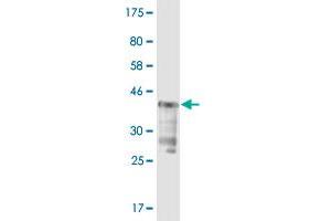 Western Blot detection against Immunogen (37. (USP5 抗体  (AA 71-180))