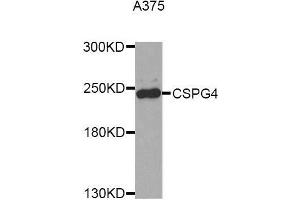 Western blot analysis of extracts of A375 cell line, using CSPG4 antibody. (NG2 抗体  (AA 1950-2210))