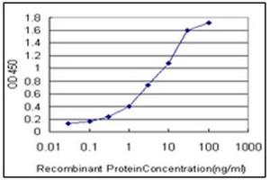 ELISA image for anti-Interleukin-1 Receptor-Associated Kinase 1 (IRAK1) (AA 530-693) antibody (ABIN614625)