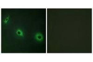 Immunofluorescence analysis of HepG2 cells, using CELSR3 antibody. (CELSR3 抗体)