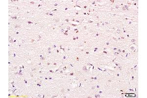 Formalin-fixed and paraffin embedded mouse heart labeled with Anti phospho-PI3K p85/PIK3R1(Tyr368) Polyclonal Antibody, Unconjugated (ABIN711041) at 1:200 followed by conjugation to the secondary antibody and DAB staining (PIK3R1 抗体  (pTyr368))