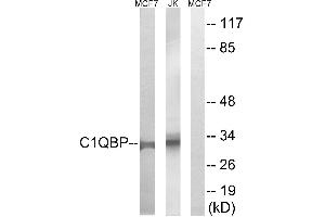 Immunohistochemistry analysis of paraffin-embedded human tonsil tissue, using C1QBP antibody. (C1QBP 抗体)