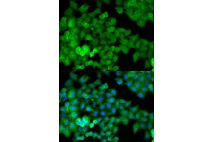 Immunofluorescence analysis of HeLa cell using JUP antibody. (JUP 抗体  (AA 1-300))