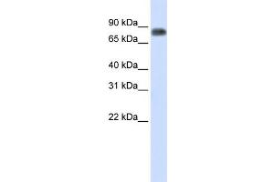 WB Suggested Anti-MST1 Antibody Titration:  0. (MST1 抗体  (Middle Region))