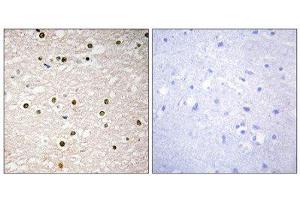 Immunohistochemistry (IHC) image for anti-Tumor Protein P73 (TP73) (Internal Region) antibody (ABIN1848960) (Tumor Protein p73 抗体  (Internal Region))