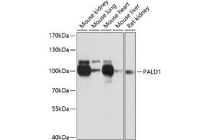 Western blot analysis of extracts of various cell lines, using P antibody (ABIN6133270, ABIN6145194, ABIN6145195 and ABIN6216692) at 1:3000 dilution. (KIAA1274 抗体  (AA 1-300))