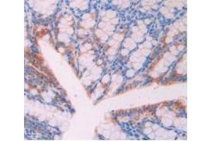 Figure. (CD47 抗体  (AA 18-219))