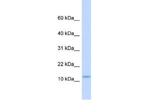 WB Suggested Anti-C9orf46 Antibody Titration:  0. (PLGRKT 抗体  (Middle Region))