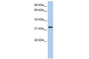 C12ORF24 antibody used at 1 ug/ml to detect target protein. (C12ORF24 抗体  (N-Term))