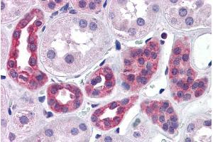 ABIN190913 (3. (SUPT16H 抗体  (Internal Region))