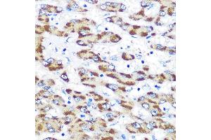 Immunohistochemistry of paraffin-embedded human liver using Presenilin 1 Rabbit pAb (ABIN3023159, ABIN3023160, ABIN3023161 and ABIN6219418) at dilution of 1:100 (40x lens). (Presenilin 1 抗体  (AA 1-160))