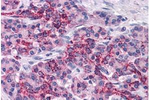Human Pancreas: Formalin-Fixed, Paraffin-Embedded (FFPE) (XIAP 抗体  (AA 75-226))