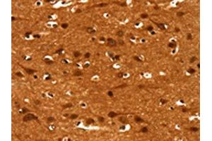 The image on the left is immunohistochemistry of paraffin-embedded Human brain tissue using ABIN7190038(CACNA1E Antibody) at dilution 1/15, on the right is treated with synthetic peptide. (CACNA1E 抗体)
