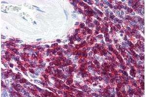 Human Spleen (formalin-fixed, paraffin-embedded) stained with CD6 antibody ABIN294221 at 10 ug/ml followed by biotinylated anti-mouse IgG secondary antibody ABIN481714, alkaline phosphatase-streptavidin and chromogen. (CD6 抗体)